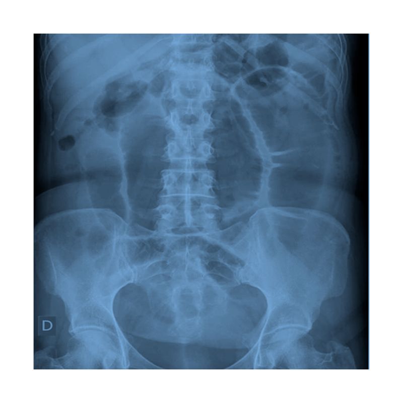 Radiografia-de-Abdomen-2-posiciones-B