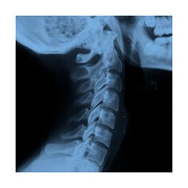 Radiografía de Columna Cervical, 2 posiciones - HSJ