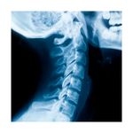 Radiografia-de-Columna-Cervical-2-posiciones-B