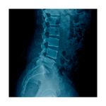 Radiografia-de-Columna-Lumbar-2-posiciones-A