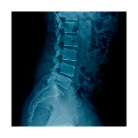 Radiografía de Columna Lumbar, 2 posiciones - HSJ