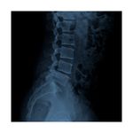 Radiografia-de-Columna-Lumbar-2-posiciones-B