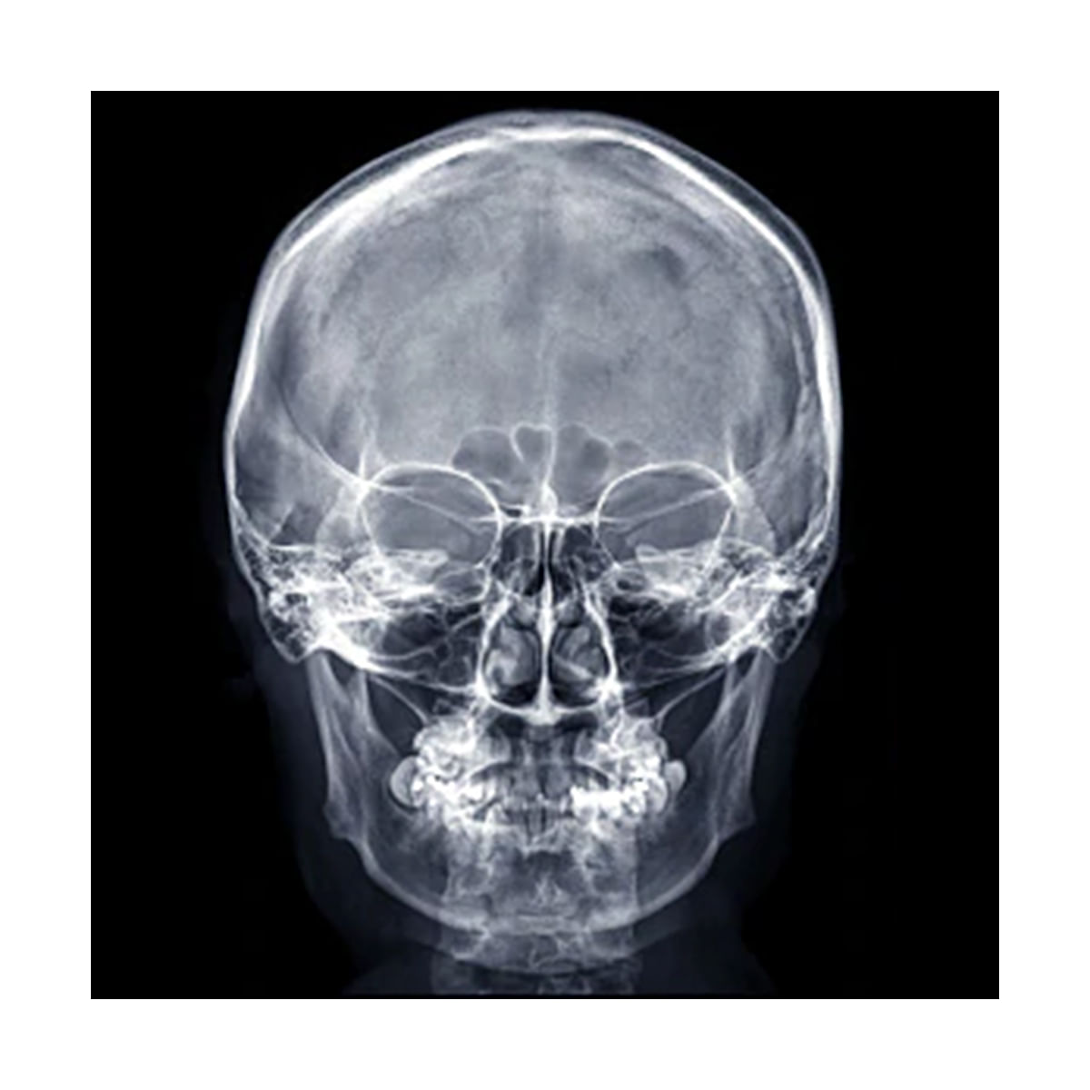 Radiografía De Cráneo 2 Posiciones Hsj 9265