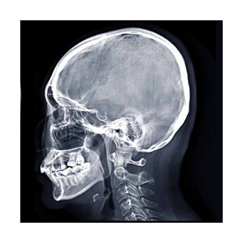 Radiografia-de-Craneo-2-posiciones-B