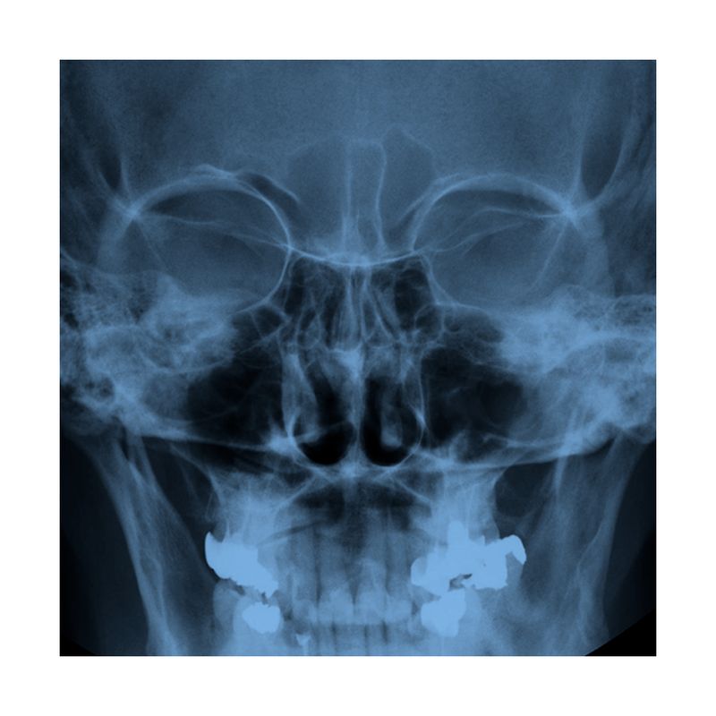 Radiografia-de-Senos-Paranasales-3-posiciones-B