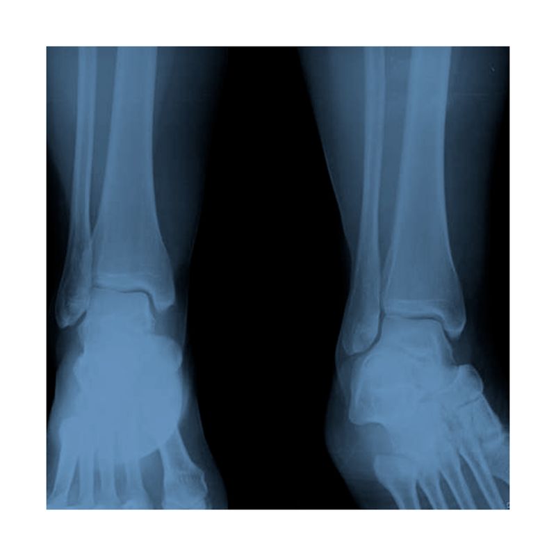 Radiografia-de-Tobillo-2-posiciones-B