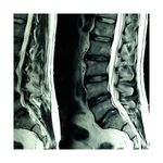 Resonancia-Magnetica-de-Columna-Lumbar-A