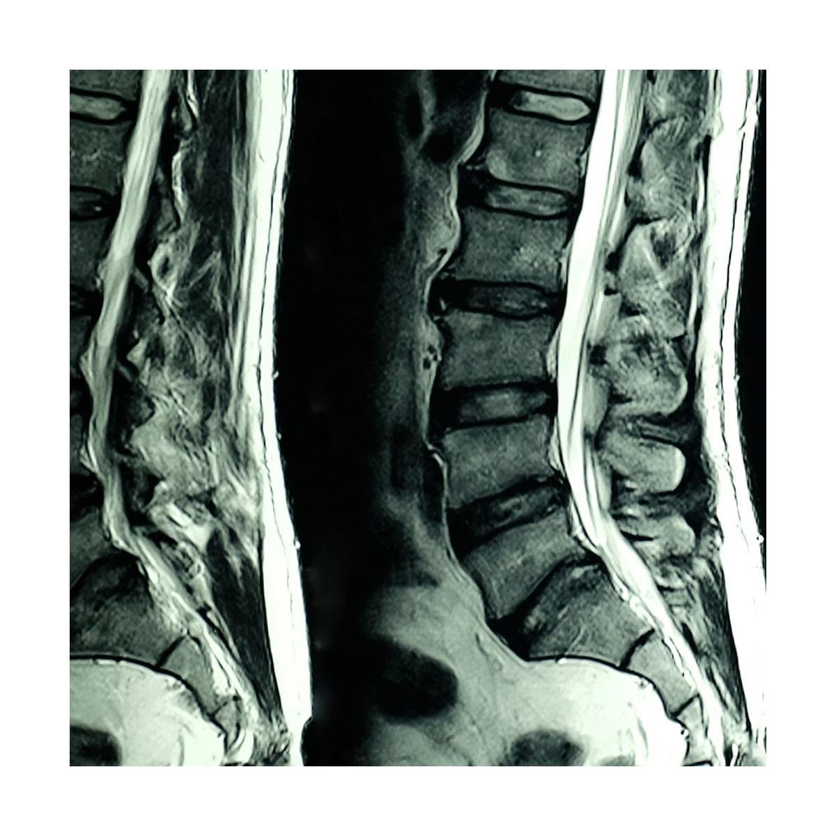 Resonancia magnética de columna lumbar simple en Hospital San José –  TecSalud Store