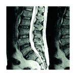 Resonancia-Magnetica-de-Columna-Lumbar-B