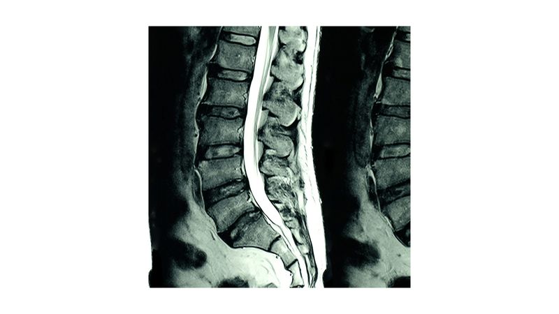 Resonancia magnética de columna lumbar simple en Hospital San José –  TecSalud Store