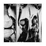 Resonancia-Magnetica-de-Rodilla-B